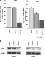 EZH2 Antibody in Western Blot (WB)