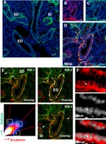 CD326 (EpCAM) Antibody in Immunohistochemistry (IHC)