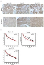 EphA2 Antibody in Immunohistochemistry (IHC)