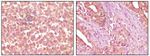 EphA2 Antibody in Immunohistochemistry (Paraffin) (IHC (P))