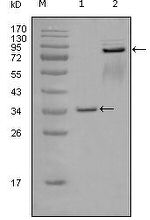 EphA7 Antibody in Western Blot (WB)