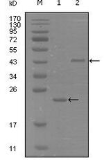 EphA8 Antibody in Western Blot (WB)