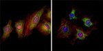 EphB2 Antibody in Immunocytochemistry (ICC/IF)