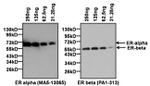 Estrogen Receptor alpha Antibody in Western Blot (WB)