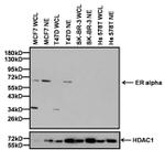 Estrogen Receptor alpha Antibody in Western Blot (WB)