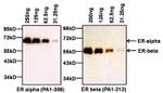 Estrogen Receptor alpha Antibody in Western Blot (WB)