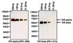 Estrogen Receptor alpha Antibody in Western Blot (WB)