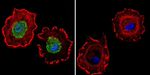 Estrogen Receptor alpha Antibody in Immunocytochemistry (ICC/IF)