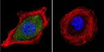 Estrogen Receptor alpha Antibody in Immunocytochemistry (ICC/IF)