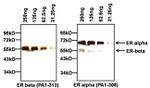 Estrogen Receptor beta Antibody in Western Blot (WB)