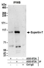 Exportin-T Antibody in Western Blot (WB)