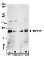 Exportin-T Antibody in Western Blot (WB)