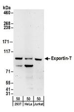 Exportin-T Antibody in Western Blot (WB)