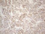 F12 Antibody in Immunohistochemistry (Paraffin) (IHC (P))