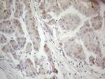 F12 Antibody in Immunohistochemistry (Paraffin) (IHC (P))