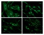 Mouse IgG (H+L) Cross-Adsorbed Secondary Antibody in Immunocytochemistry (ICC/IF)