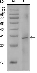 Factor VIII Antibody in Western Blot (WB)