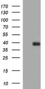 FA2H Antibody in Western Blot (WB)