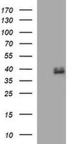 FA2H Antibody in Western Blot (WB)