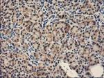 FABP2 Antibody in Immunohistochemistry (Paraffin) (IHC (P))