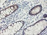 FABP2 Antibody in Immunohistochemistry (Paraffin) (IHC (P))