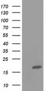 FABP2 Antibody in Western Blot (WB)