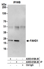 FAHD1 Antibody in Immunoprecipitation (IP)