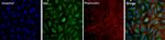 FAK Antibody in Immunocytochemistry (ICC/IF)