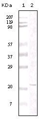 FAK Antibody in Western Blot (WB)