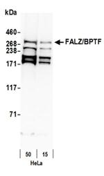 FALZ/BPTF Antibody in Western Blot (WB)