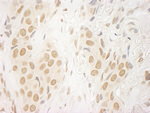 FALZ/BPTF Antibody in Immunohistochemistry (IHC)