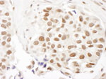 FANCD2 Antibody in Immunohistochemistry (IHC)