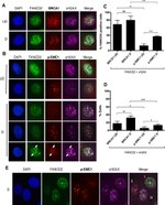 FANCD2 Antibody in Immunocytochemistry (ICC/IF)