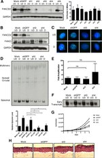 FANCD2 Antibody in Western Blot, Immunocytochemistry (WB, ICC/IF)