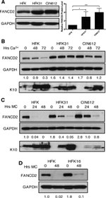 FANCD2 Antibody in Western Blot (WB)