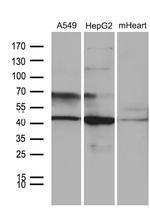 FBXO22 Antibody in Western Blot (WB)