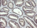 FBXO42 Antibody in Immunohistochemistry (Paraffin) (IHC (P))