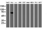 FBXO42 Antibody in Western Blot (WB)