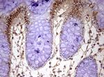 FBXW7 Antibody in Immunohistochemistry (Paraffin) (IHC (P))