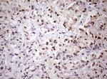 FBXW7 Antibody in Immunohistochemistry (Paraffin) (IHC (P))