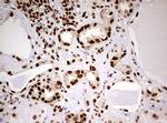 FBXW7 Antibody in Immunohistochemistry (Paraffin) (IHC (P))