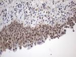 FBXW7 Antibody in Immunohistochemistry (Paraffin) (IHC (P))