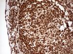 FBXW7 Antibody in Immunohistochemistry (Paraffin) (IHC (P))