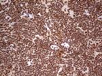 FBXW7 Antibody in Immunohistochemistry (Paraffin) (IHC (P))