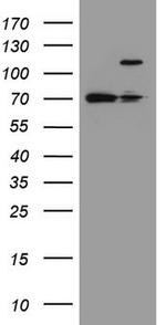 FBXW7 Antibody in Western Blot (WB)