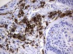 FCGR2A Antibody in Immunohistochemistry (Paraffin) (IHC (P))