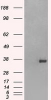 FCGR2A Antibody in Western Blot (WB)