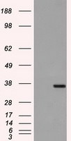 FCGR2A Antibody in Western Blot (WB)