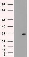 FCGR2A Antibody in Western Blot (WB)