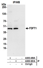 FDFT1 Antibody in Immunoprecipitation (IP)